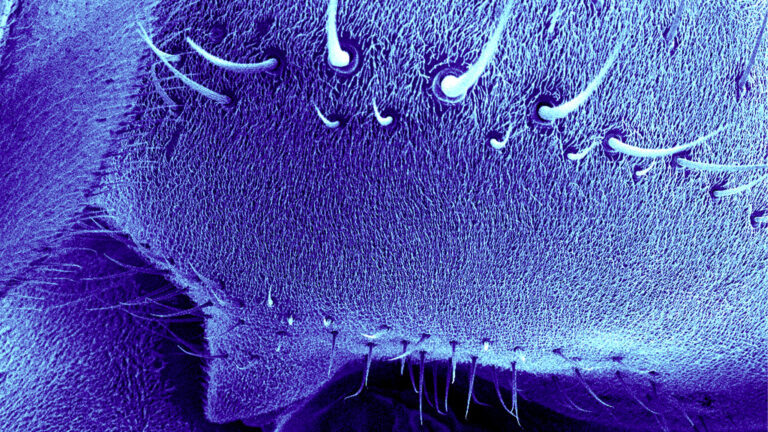 A microscope slide of Fly Spikes