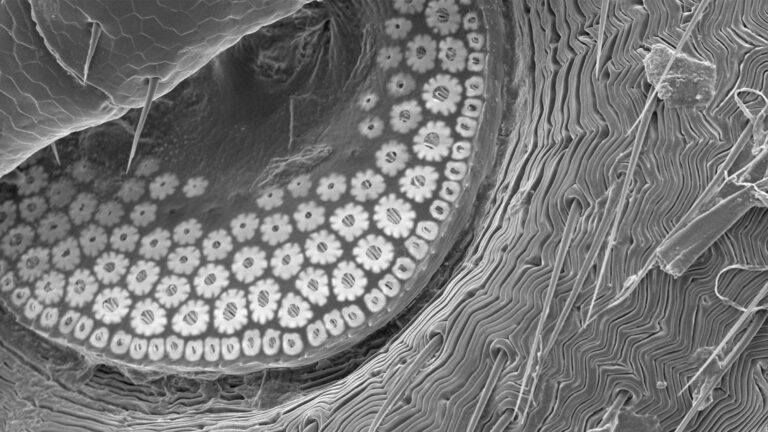A microscope slide of the underside of a tick